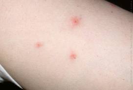 Name:  bed bugs.jpg
Views: 894
Size:  3.9 KB